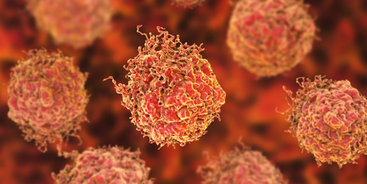 نابودی‌ سلول‌های سرطانی با روشی جدید