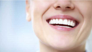 تصویر هزینه‌های دندانپزشکی نجومی شد؛ ۱۰۰ میلیون برای بازسازی دندان‌!
